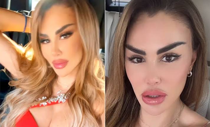 Ninel Conde recibe fuertes críticas por su rostro tras aparecer en TV